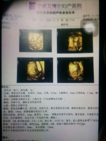 journal_insert_pic_496293850