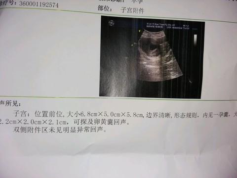 journal_insert_pic_497876642