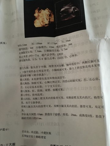 journal_insert_pic_499564705