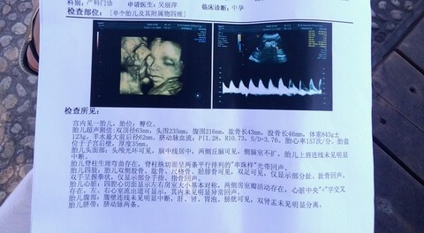 journal_insert_pic_499216268