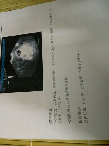 journal_insert_pic_500352736