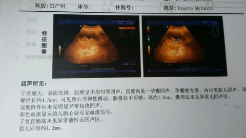 journal_insert_pic_500097694