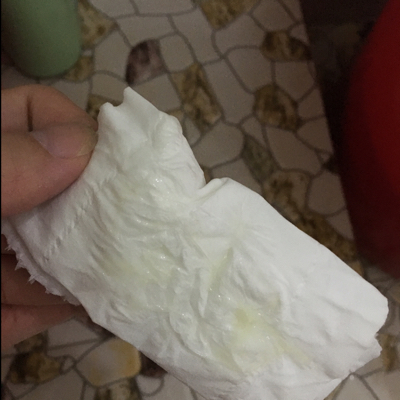 分泌物是这个样子的,没什么事吧.