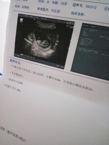 journal_insert_pic_501249504