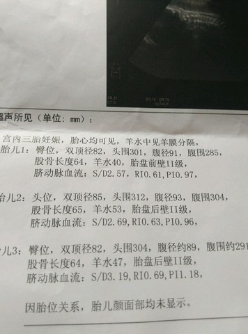 journal_insert_pic_503315113