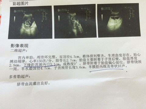 journal_insert_pic_504018606