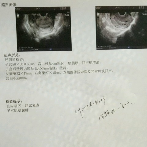 journal_insert_pic_505500488
