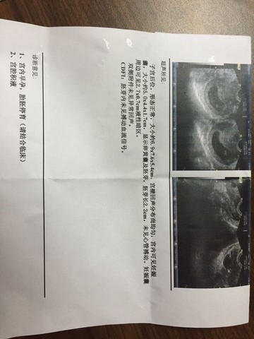journal_insert_pic_513976168