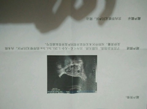 journal_insert_pic_513995600
