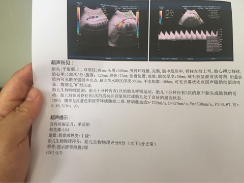 journal_insert_pic_515123197