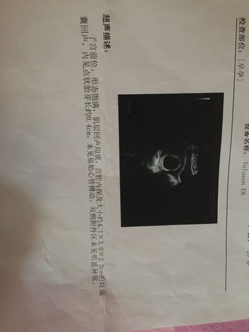 journal_insert_pic_517640617