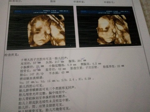journal_insert_pic_520040520