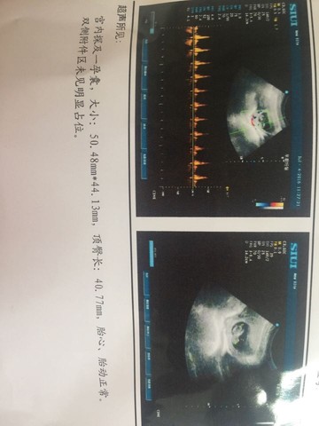 journal_insert_pic_523448108