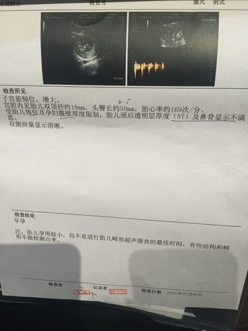 journal_insert_pic_524285754