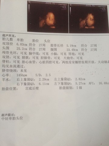 journal_insert_pic_526791235