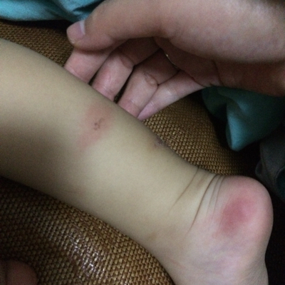 问答 幼儿期1-3岁 少女不才1岁8个月2016-07-11 推荐回答