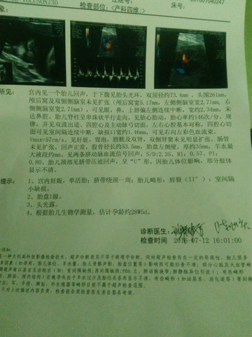 journal_insert_pic_528541790
