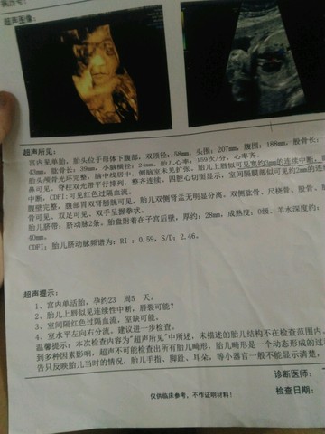 journal_insert_pic_528541757
