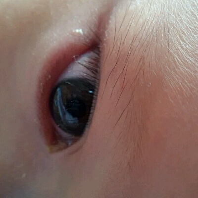 宝宝七个月了,眼屎特别多,黄色,晚上睡觉眼睛都沾一起