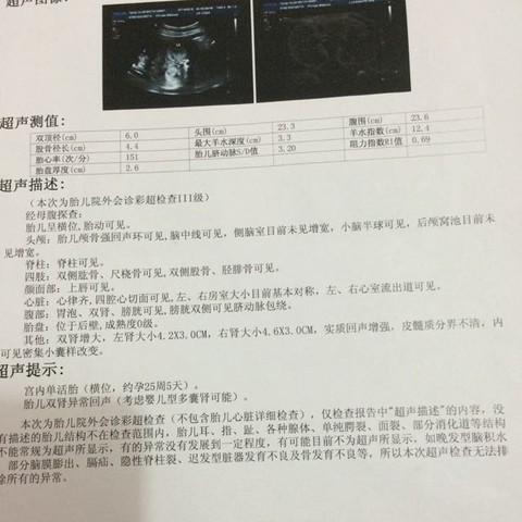 journal_insert_pic_529919111