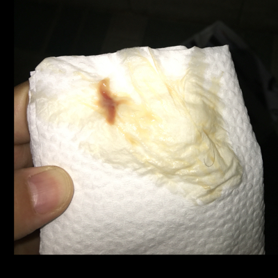 昨天去产检,听了胎心,正常,验了个白带,晚上上厕所发现内裤上有点褐色