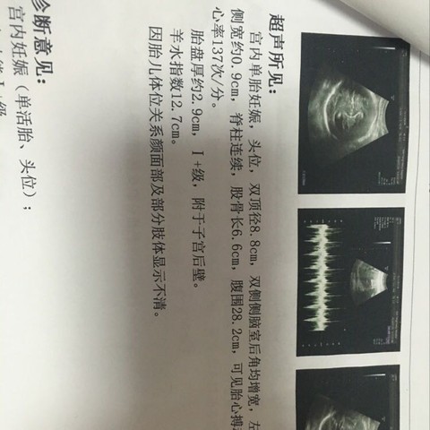 journal_insert_pic_534854169