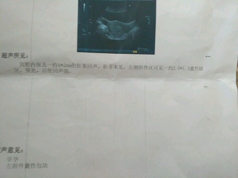 journal_insert_pic_535272356