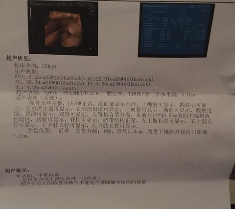 journal_insert_pic_535117867