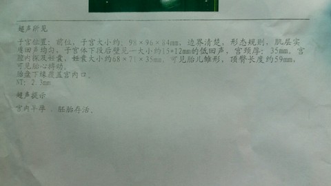 journal_insert_pic_537832940