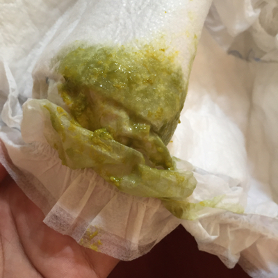 拉绿色的粑粑,我听别人说有可能是不吸收铁元素