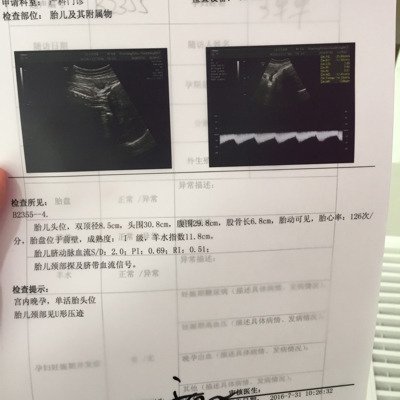 journal_insert_pic_542835097