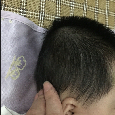 宝宝两个半月,后面的头一边高一边低,挺明显的,低