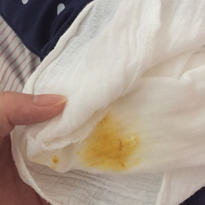 宝宝今天拉黄色粑粑五六次了正常吗?