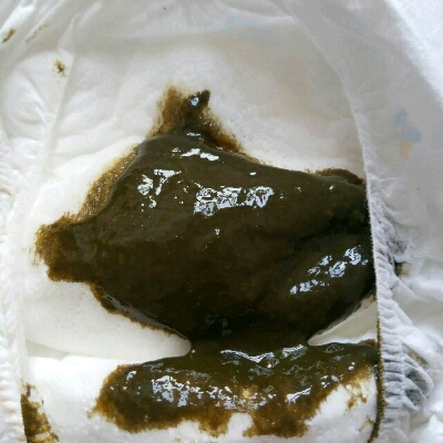 宝宝这两天拉肚子 吃了药 为什么便便是黑绿色的 和吃药有关系吗