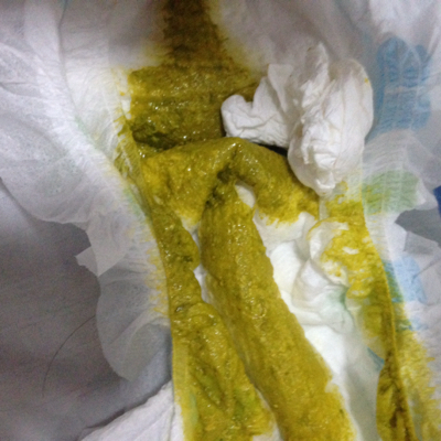 宝宝这样是拉稀了么,一天两次,也酸酸的气味,现在6个月