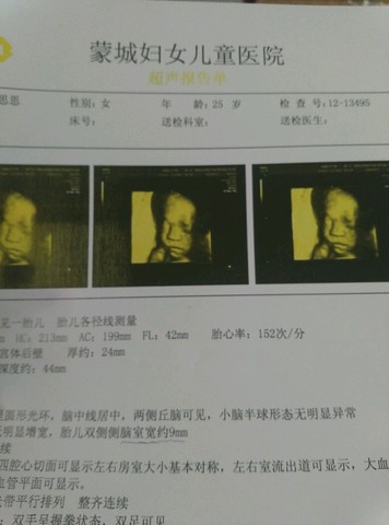 journal_insert_pic_570411701