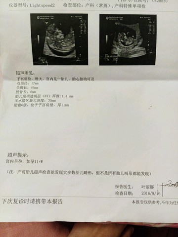 journal_insert_pic_572237612