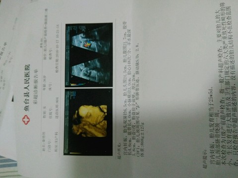 journal_insert_pic_591762530