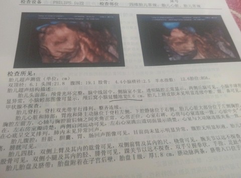 journal_insert_pic_628082483