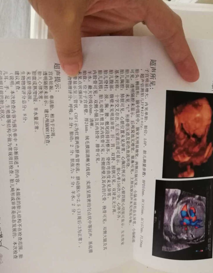 journal_insert_pic_1146310864